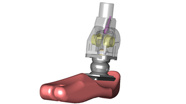 Adaptive Sports ankle joint prosthesis